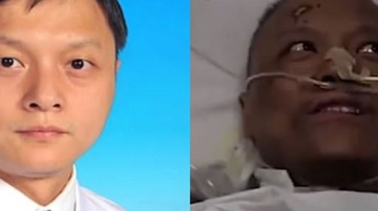 Απίστευτη επιπλοκή: Μαύρισε το δέρμα δύο γιατρών που προσβλήθηκαν απ' τον... | Διεθνή Ειδήσεις