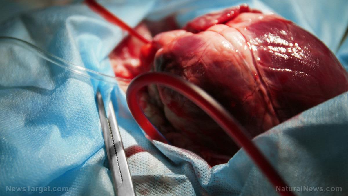 Η παγκόσμια αγορά καρδιακών βηματοδοτών σημειώνει ΜΕΓΑΛΗ “άνοδο” λόγω των θανατηφόρων m-volίων Covid που φράζουν το αίμα και καταπονούν την καρδιά