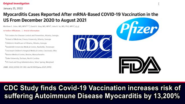 ΗΠΑ: Μελέτη του CDC Διαπιστώνει ότι ο εμβολιασμός για Covid-19 Αυξάνει τον Κίνδυνο να Πάθει Κανείς Αυτοάνοσο Νόσημα Μυοκαρδίτιδας κατά 13.200%